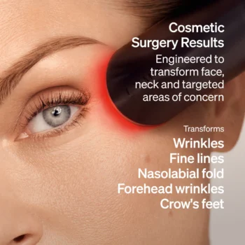 at home laser for wrinkles